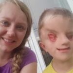 世界で60例しかない顔面奇形で生まれた6歳男児の母親が伝えたいこと…