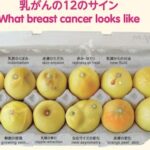 自分の乳がん写真をSNSに投稿した女性…乳がんの原因はしこりだけではなかった…
