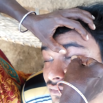 インドの眼球クリーニング…針金を使いゴロゴロ異物がとれまくる衝撃の動画が話題に…