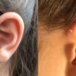 耳瘻孔の本当の意味…100人に1人が持つ耳の付け根の穴の意味が話題に…